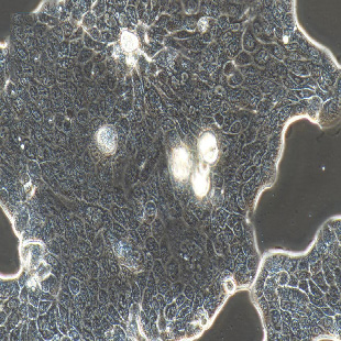 Calu-3 人肺腺癌細胞