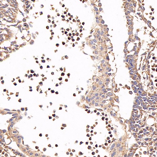 Anti -CD133 Mouse mAb