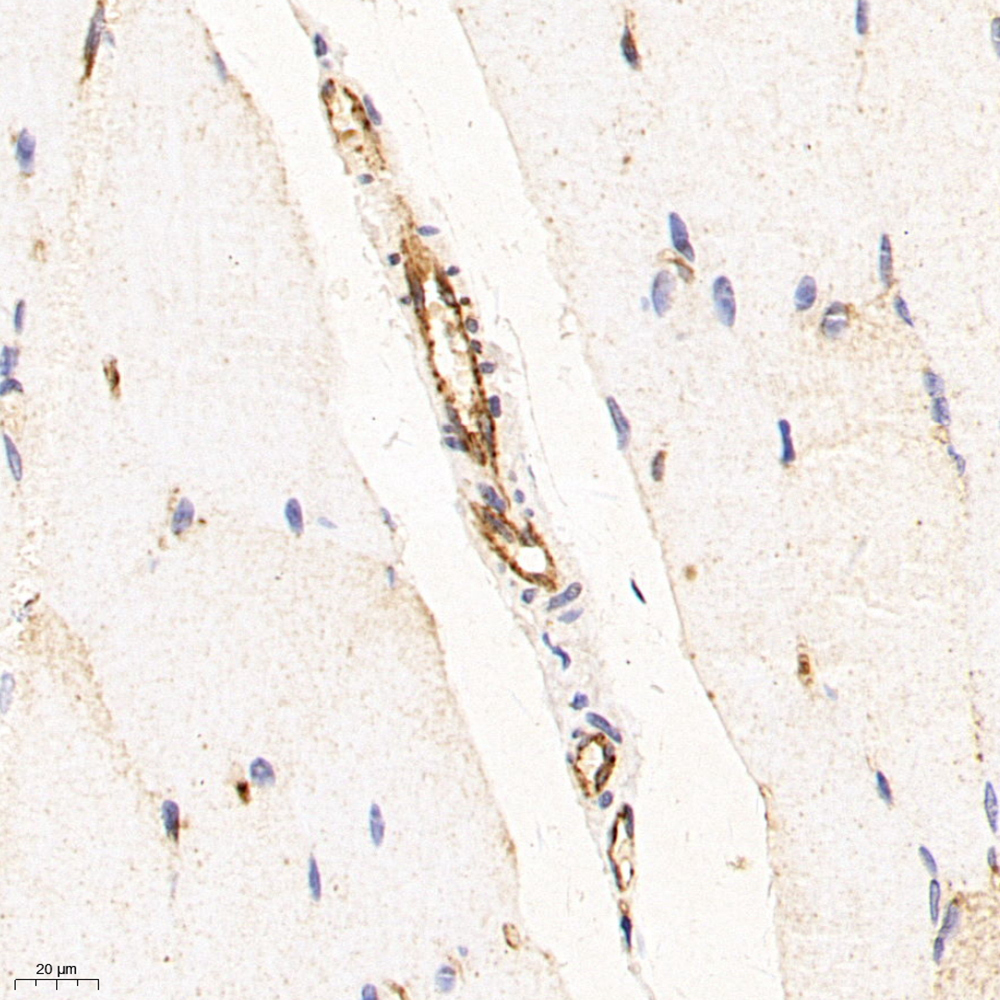 Anti -CD31 Mouse mAb