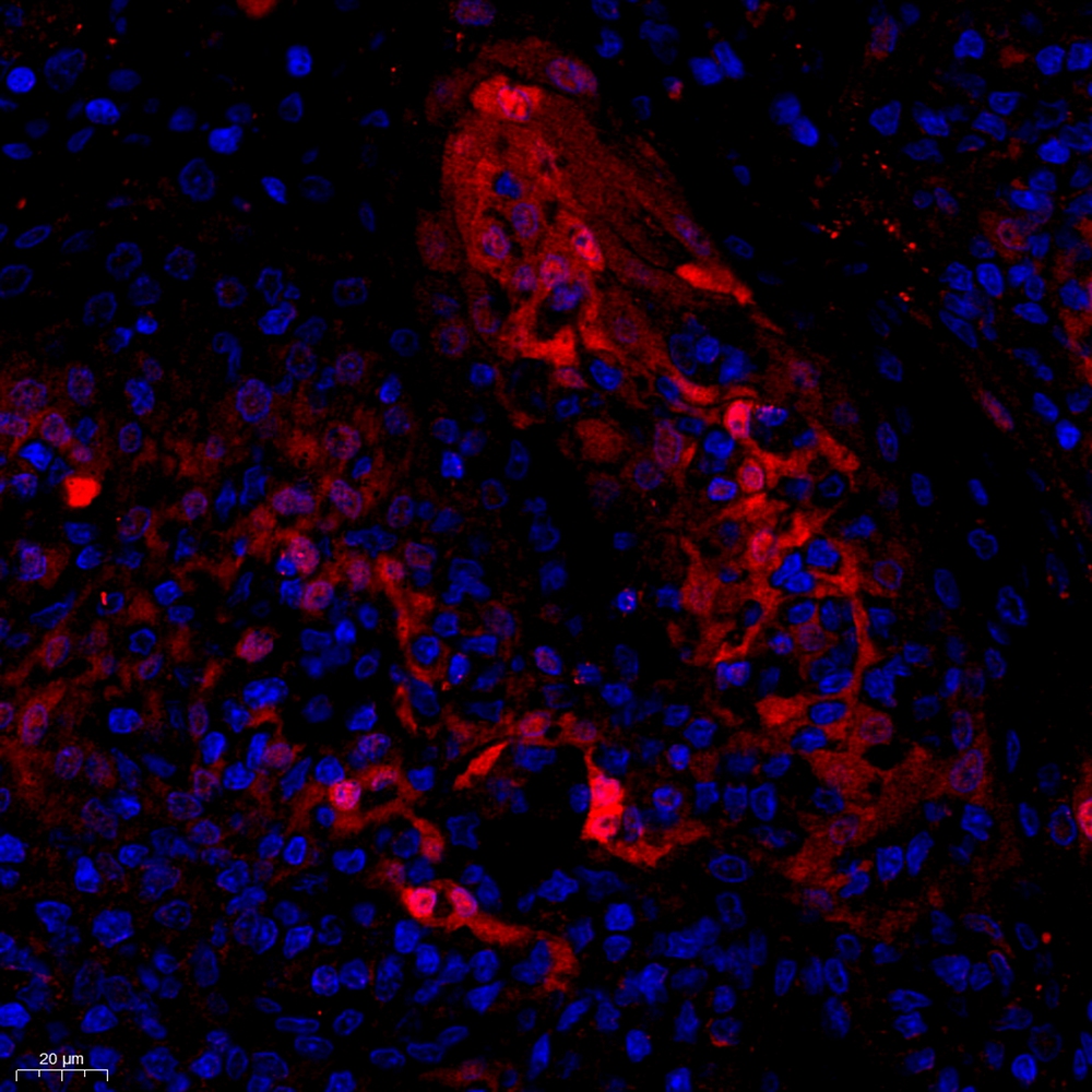 Anti -Granzyme K Rabbit pAb