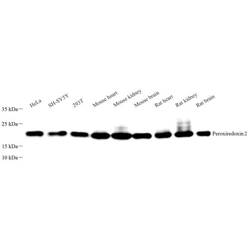 Anti -Peroxiredoxin 2/PRP Rabbit pAb