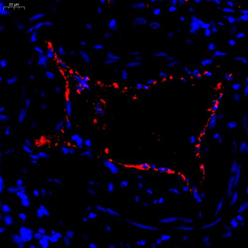 Anti -Von Willebrand Factor Rabbit pAb