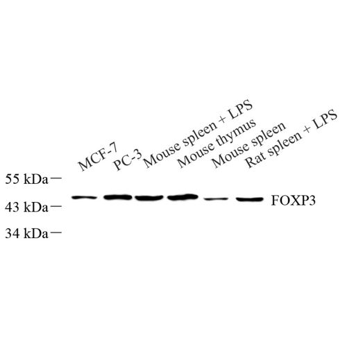 Anti -FOXP3 Rabbit pAb