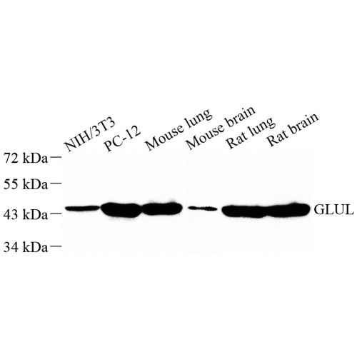 Anti -Glutamine Synthetase Rabbit pAb